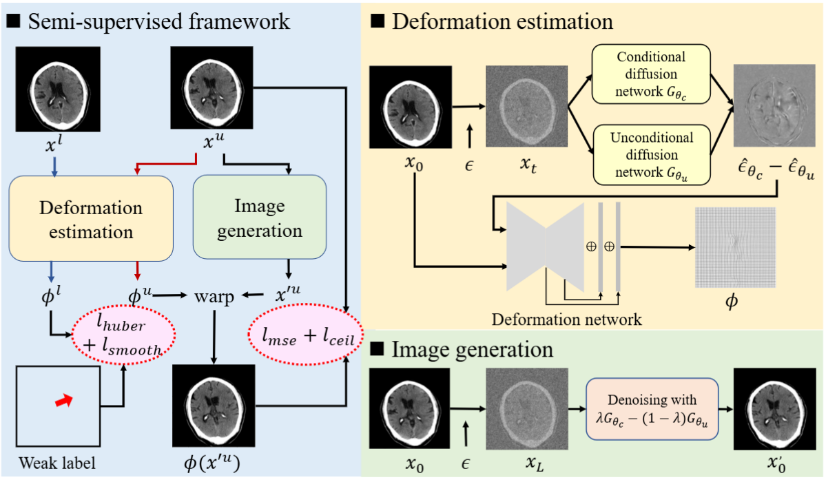 Diffusion Model Based Semi-Supervised Learning on Brain Hemorrhage Images for Efficient Midline Shift Quantification
