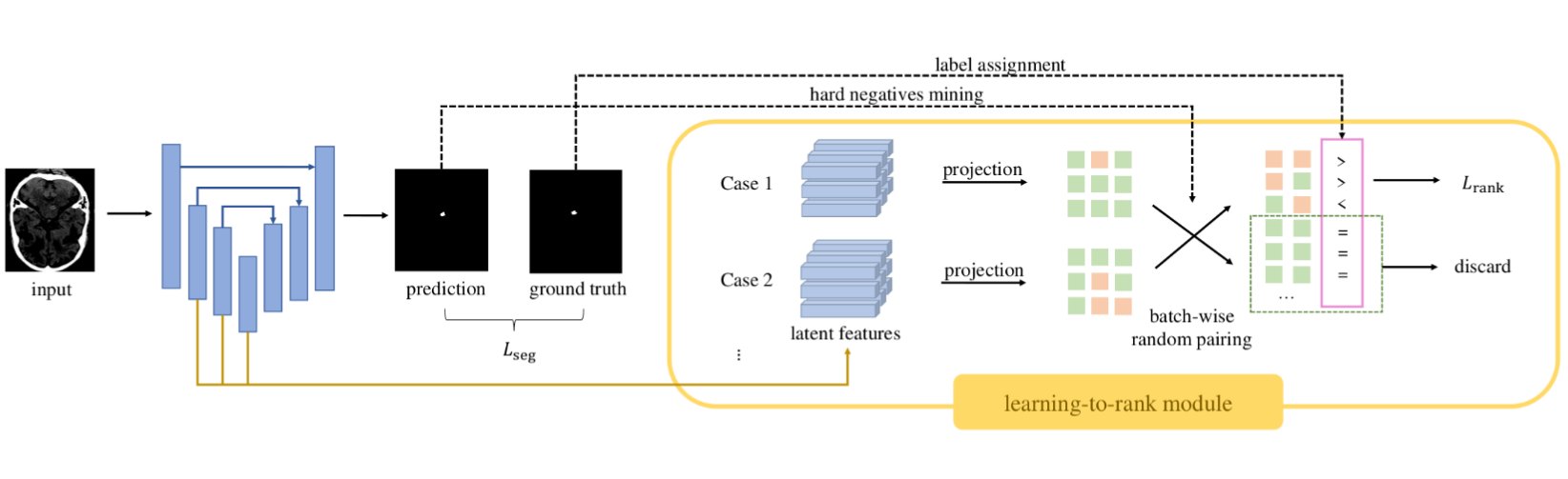 Segmentation of Tiny Intracranial Hemorrhage via Learning-to-Rank Local Feature Enhancement